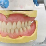Complete Denture Set Reading