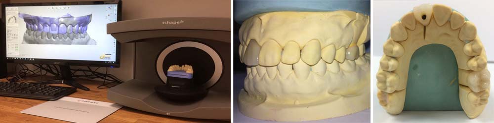 new dental crown technology berkshire